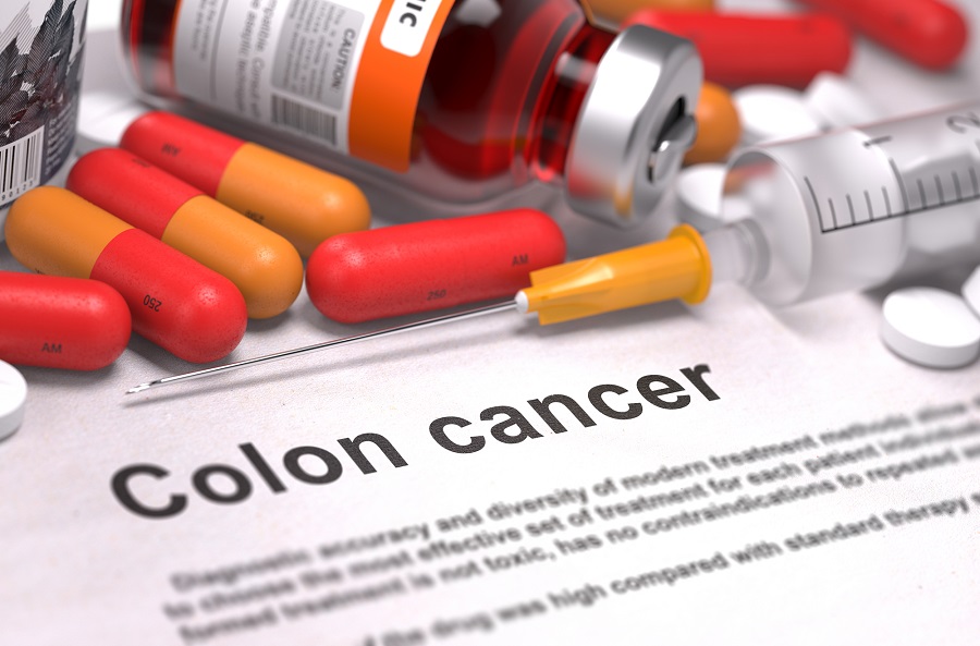 What Everyone Must Know About Colon Cancer